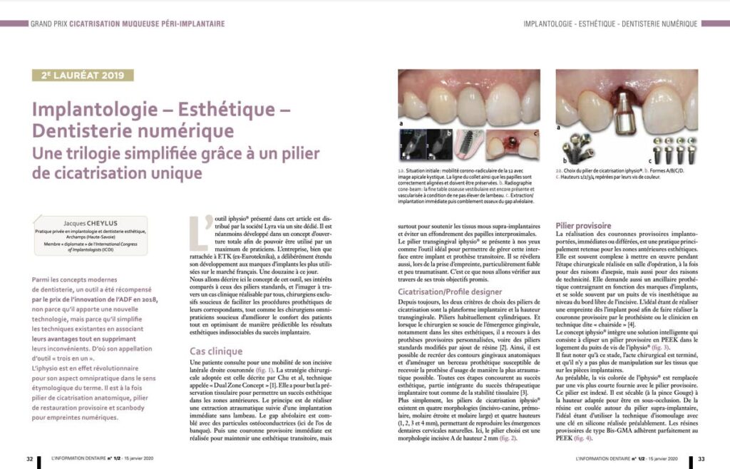 Implantologie - esthétique - dentisterie numérique - pilier de cicatrisation unique
