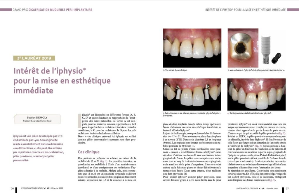 Intérêt de l'iphysio pour mise en esthétique immédiate