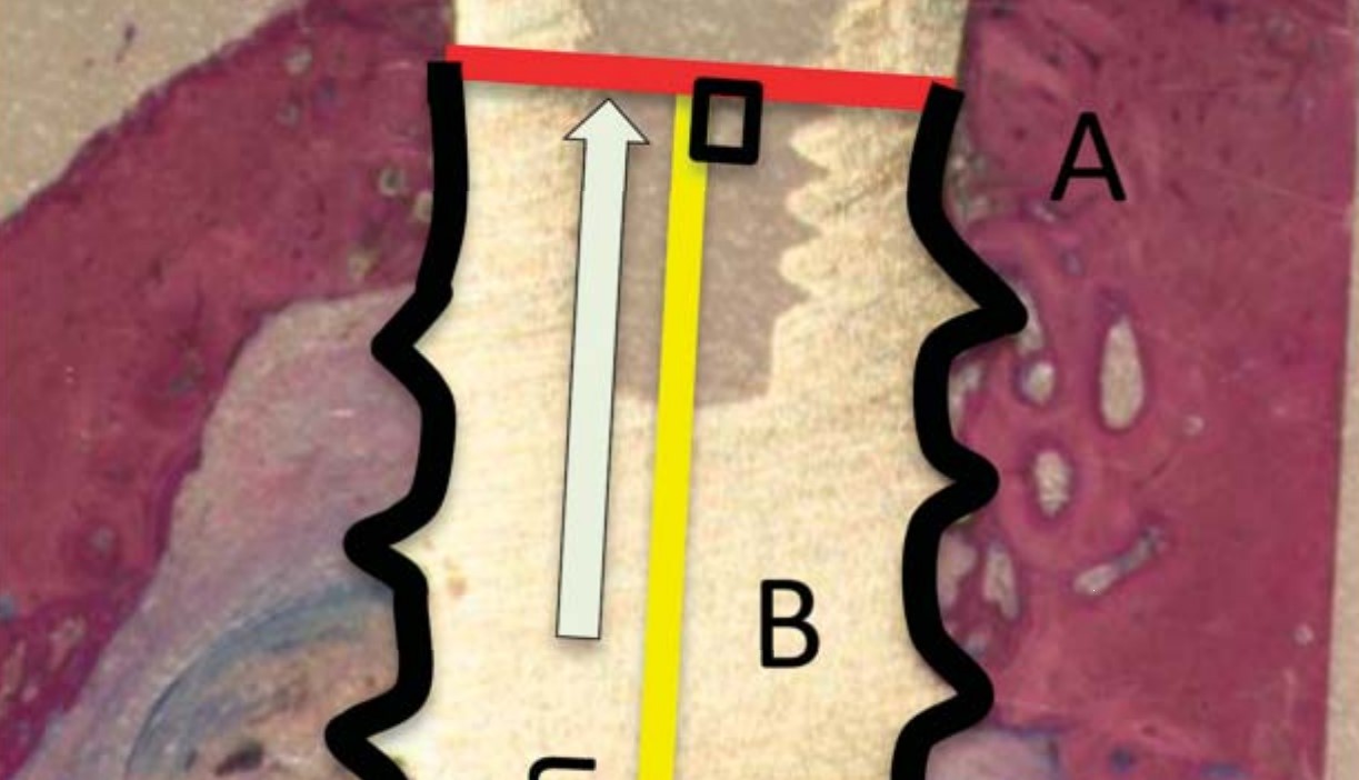 thèse scientifique dentaire