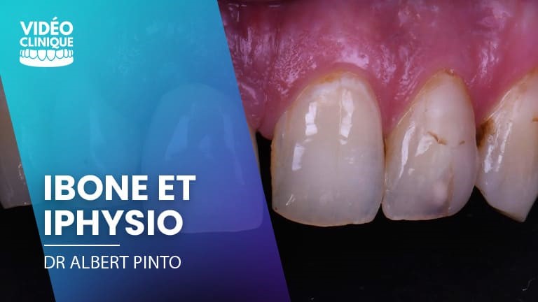 cas clinique ibone iphysio