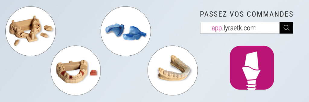 impression 3D CAD CAM