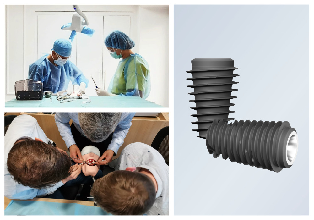 formation essentiel en implantologie