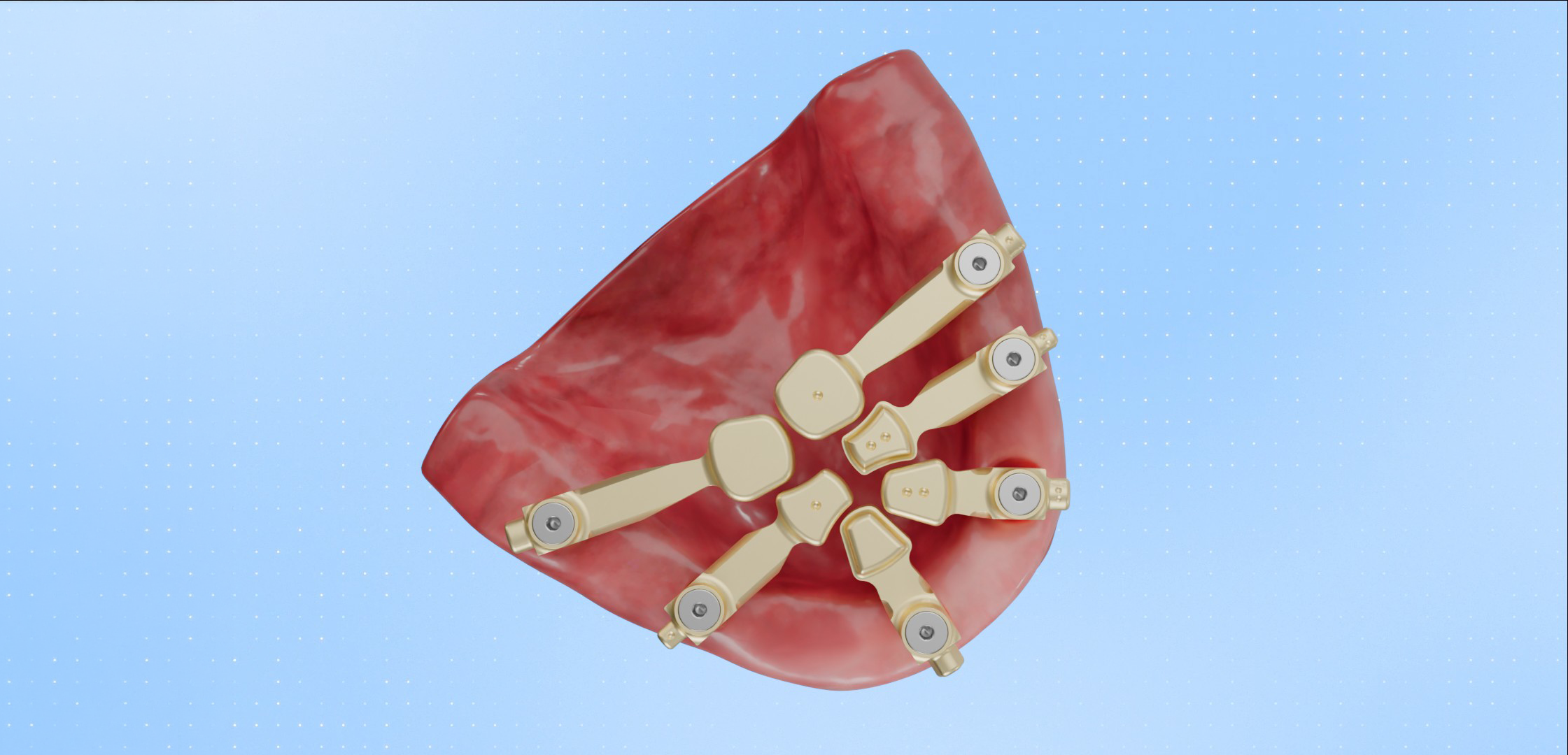 iflag reverso